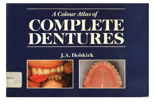A colour atlas of complete dentures.