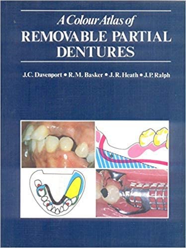 A Color Atlas of Removable Partial Dentures