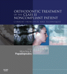 Orthodontic Treatment of the Class II Noncompliant Patient