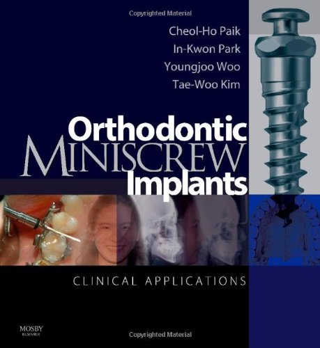 Orthodontic Miniscrew Implants