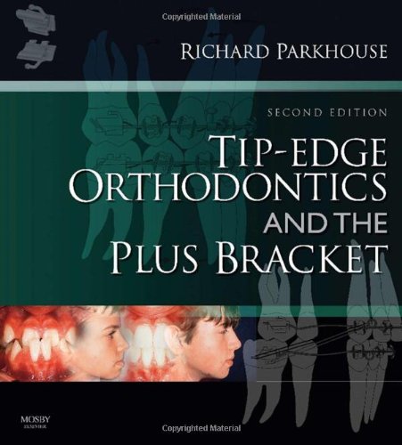 Tip-Edge Orthodontics and the Plus Bracket