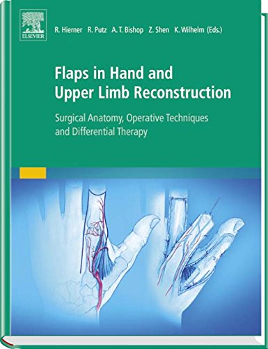 Flaps in Hand and Upper Limb Reconstruction