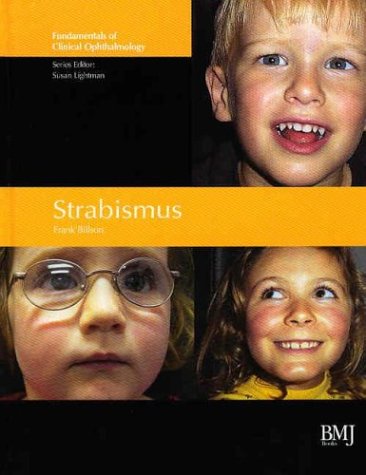 Strabismus