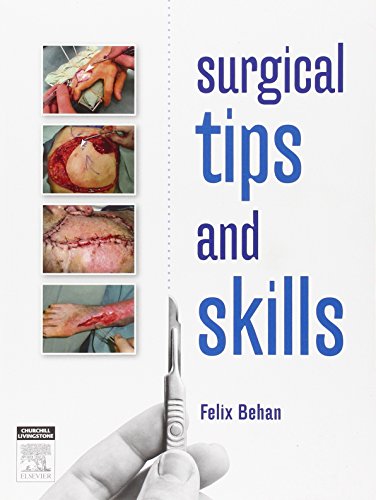 Surgical Tips and Skills