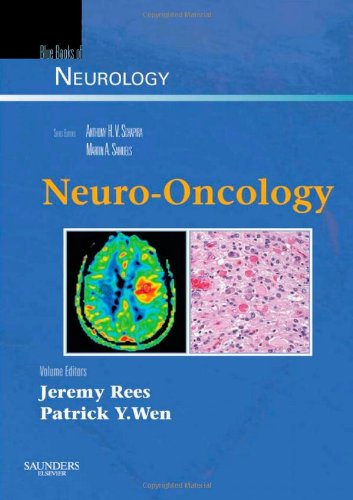 Neuro-Oncology, 36