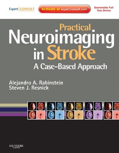 Practical Neuroimaging in Stroke