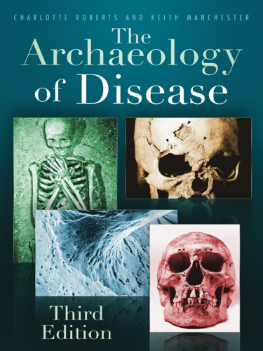 The Archaeology of Disease.