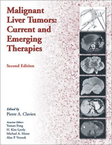 Malignant Liver Tumors: Current And Emerging Therapies