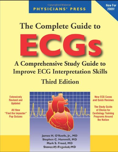 The Complete Guide to ECGs