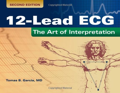 12-Lead Ecg