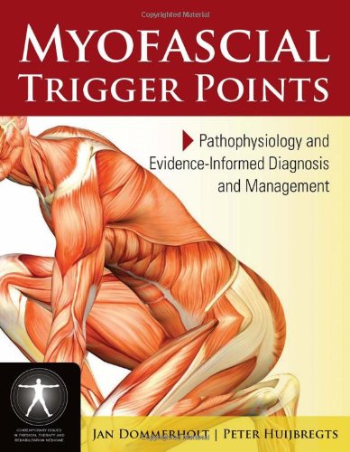 Myofascial Trigger Points