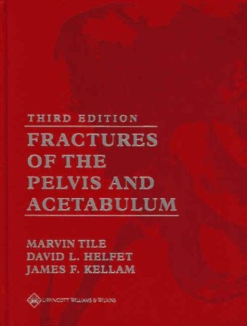 Fractures of the Pelvis and Acetabulum