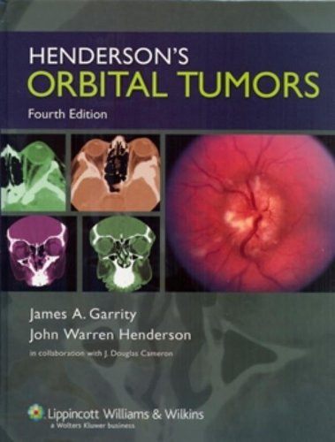 Henderson's Orbital Tumors