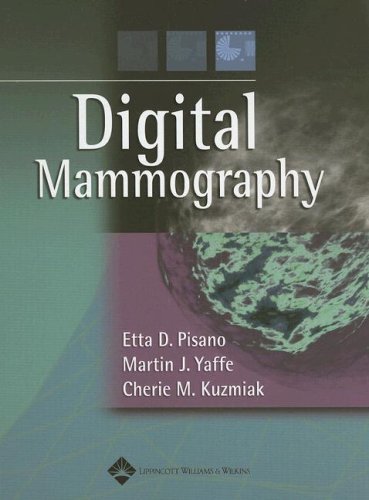 Digital Mammography