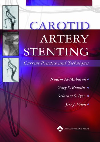 Carotid Artery Stenting