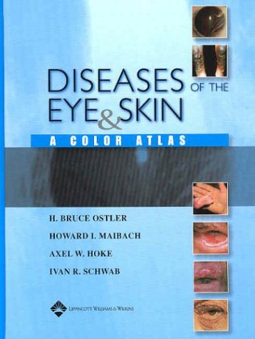 Diseases of the Eye and Skin