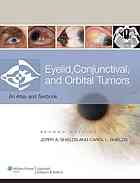 Eyelid, Conjunctival, and Orbital Tumors and Intraocular Tumors