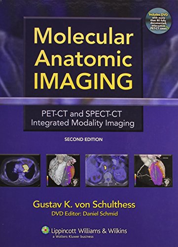 Molecular Anatomic Imaging