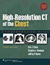 High-Resolution CT of the Chest