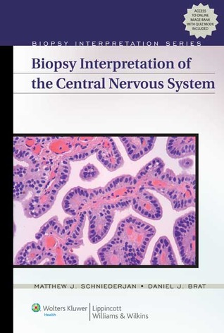 Biopsy Interpretation of the Central Nervous System