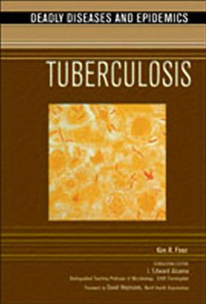 Tuberculosis