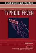 Typhoid Fever