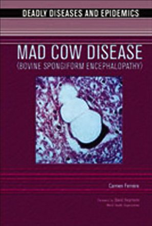 Mad Cow Disease (Bovine Spongiform Encephalopathy)