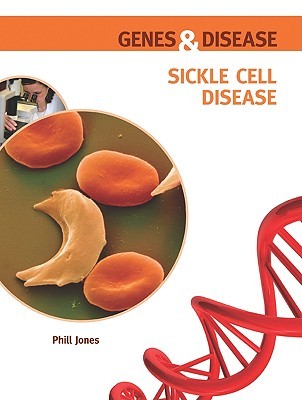 Sickle Cell Disease