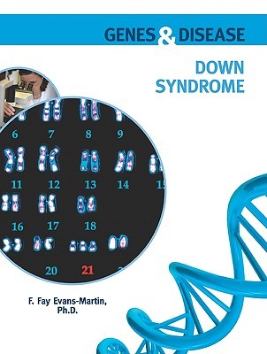 Down Syndrome