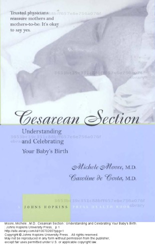 Cesarean Section