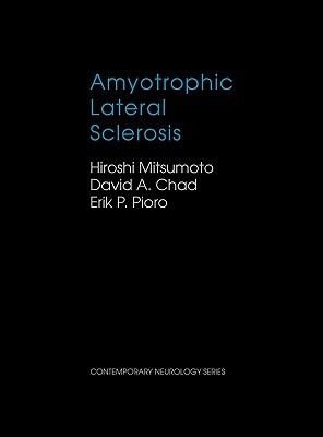 Amyotrophic Lateral Sclerosis (Contemporary Neurology Series 49)