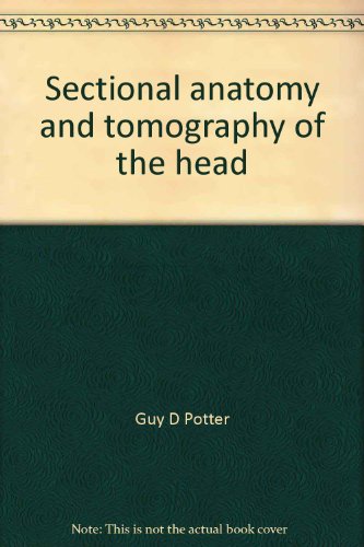 Sectional Anatomy and Tomography of the Head