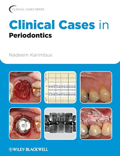 Clinical Cases in Periodontics