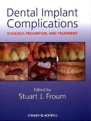 Dental Implant Complications