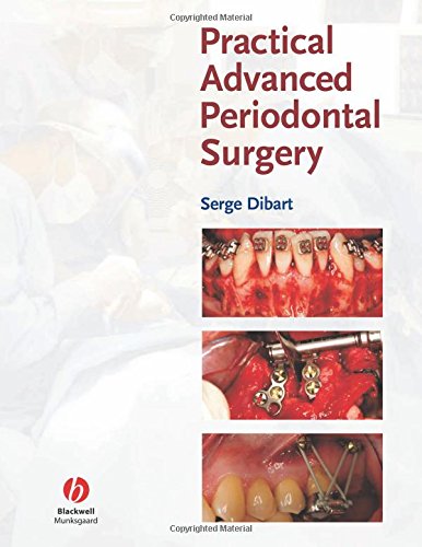 Practical Advanced Periodontal Surgery