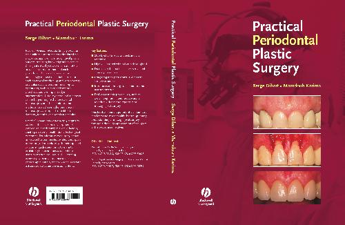 Periodontal Plastic Surgery