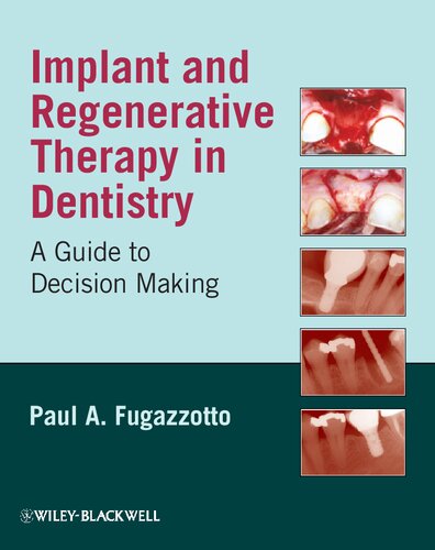 Implant and Regenerative Therapy in Dentistry: A Guide to Decision Making