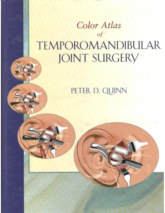 Color Atlas Of Temporomandibular Joint Surgery