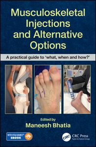 Musculoskeletal injections and alternative options : a practical guide to 'what, when and how?'