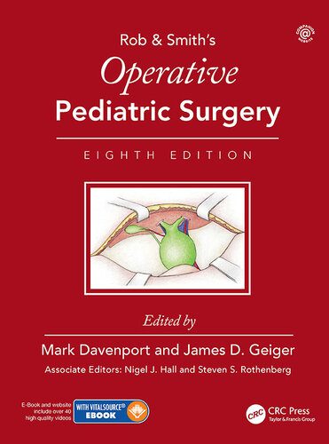 Operative Pediatric Surgery