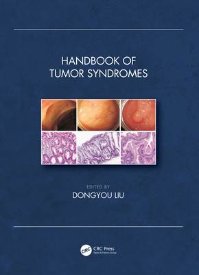 Handbook of Tumor Syndromes