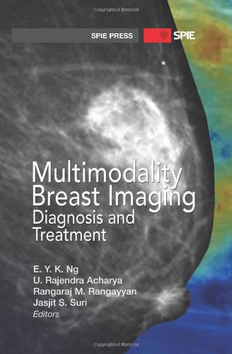 Multimodality Breast Imaging