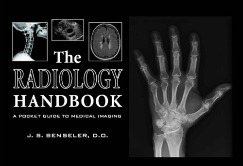 The Radiology Handbook