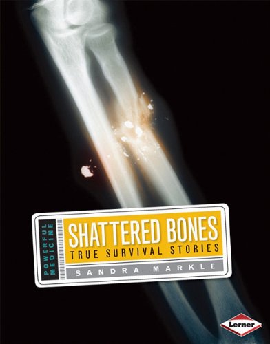 Shattered Bones