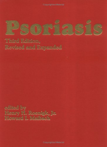 Psoriasis