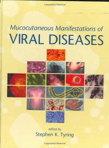 Mucocutaneous Manifestations of Viral Diseases