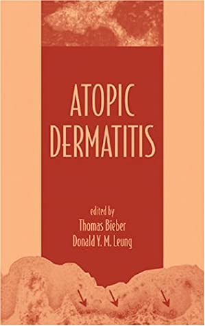 Atopic Dermatitis