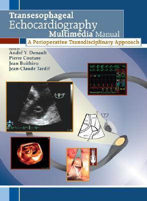 Transesophageal Echocardiography Multimedia Manual