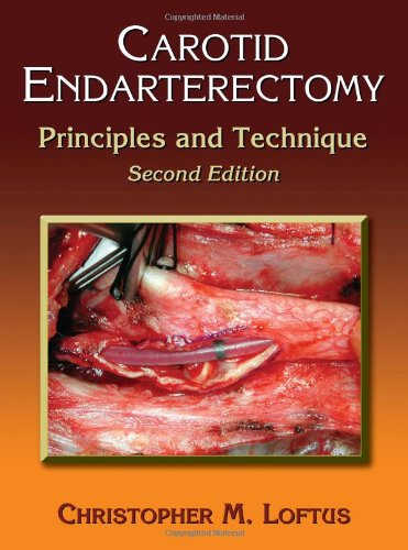 Carotid Endarterectomy