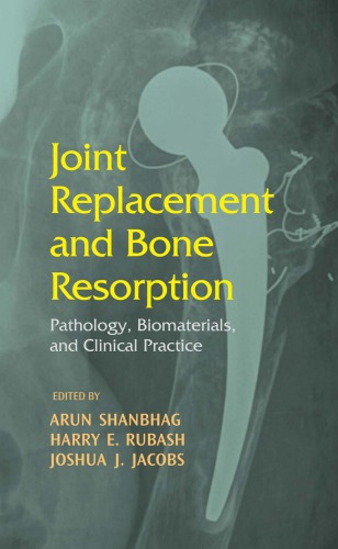 Joint Replacement and Bone Resorption